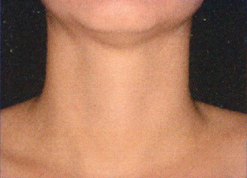 neckgrade vol 1
