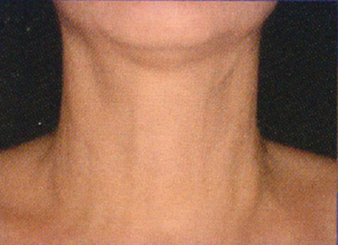 neckgrade vol 2
