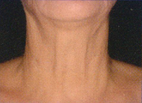 neckgrade vol 3