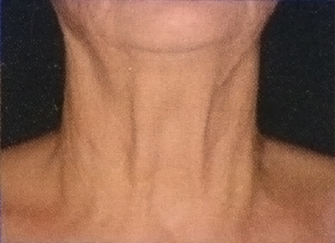 neckgrade vol 4