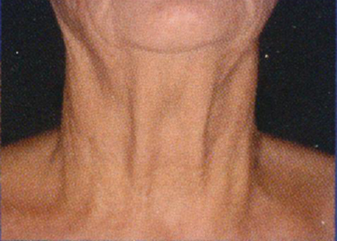 neckgrade vol 5